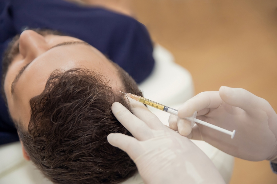 Mezoterapia igłowa skóry głowy po konsultacji trychologicznej Gabinet trychologiczny i mezoterapia igłowa